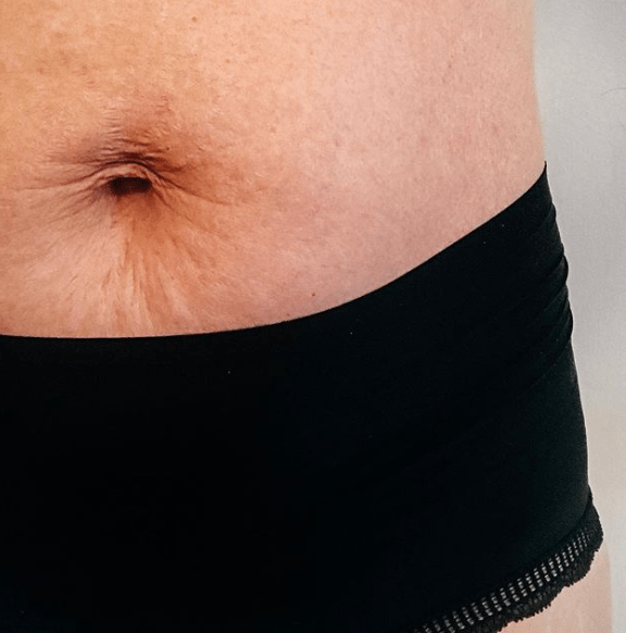 Dear stomach, I don’t hate you